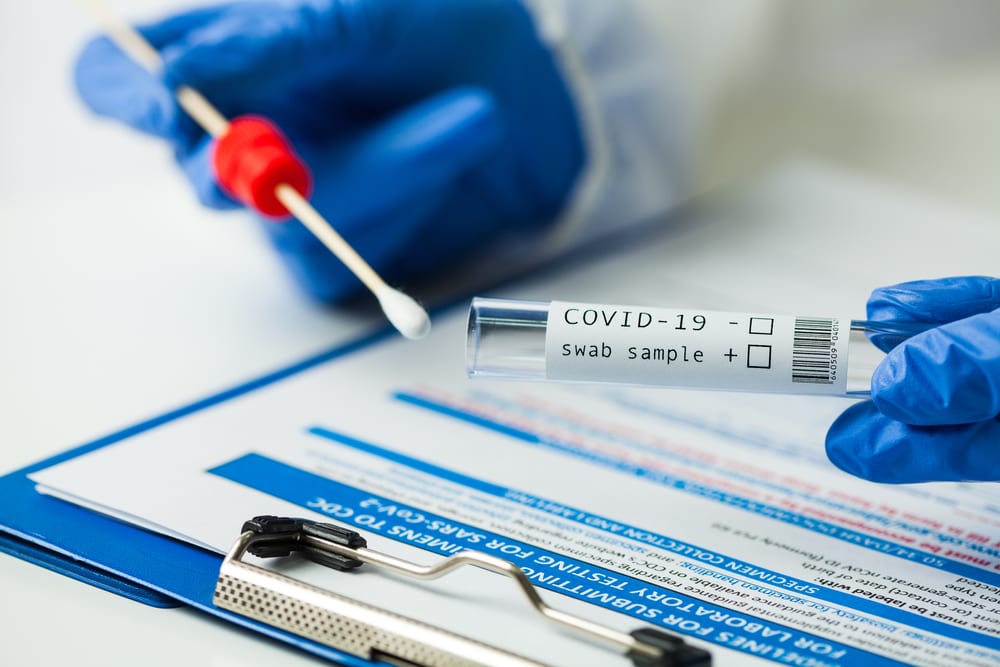if you have health insurance, COVID tests are likely covered